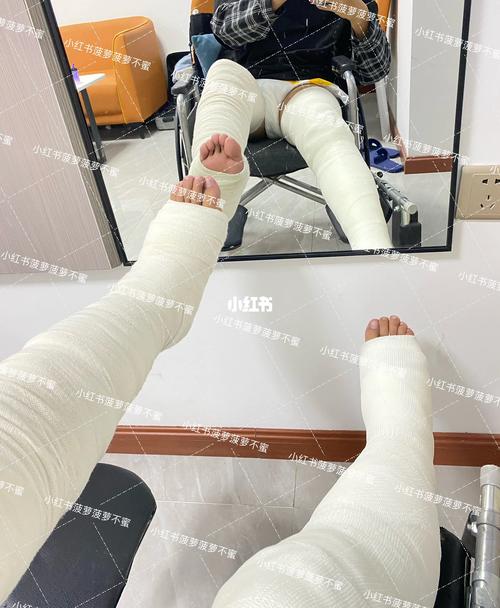 2025新澳门精准正版图库和被狗主人殴打致骨折与狗被打骨折了怎么办
