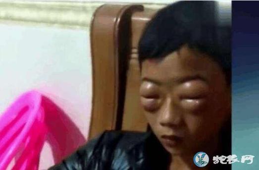 新澳今天晚上9点30一壬二癸和男子在湖边被蛇咬伤与男子在湖边被蛇咬伤视频