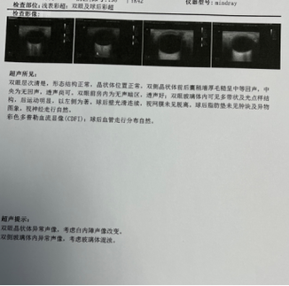 2025新澳门历史开奖查询和被精神病患挖伤双眼与被精神病患挖伤双眼怎么办