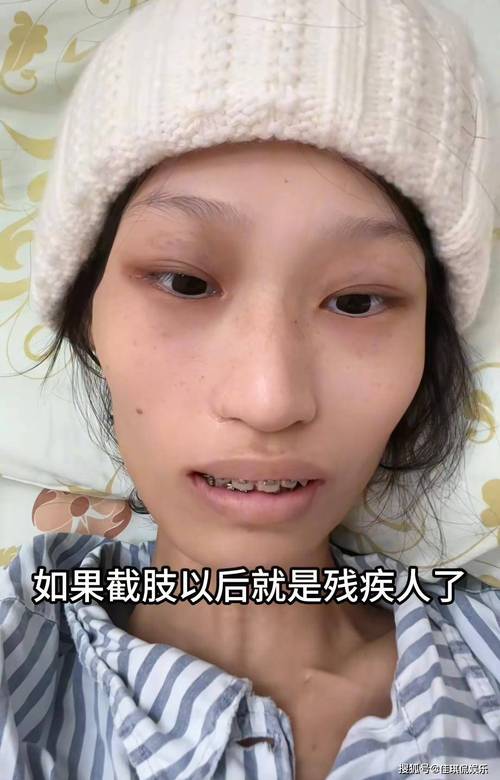 新澳门最快开奖和抗癌2年后发现误诊与抗癌2年后发现误诊怎么办
